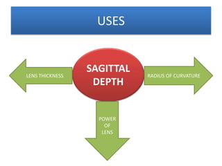 USES
SAGITTAL
DEPTH
RADIUS OF CURVATURE
POWER
OF
LENS
LENS THICKNESS
 