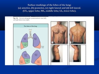 Surface markings of the lobes of the lung:
(a) anterior, (b) posterior, (c) right lateral and (d) left lateral.
     (UL, upper lobe; ML, middle lobe; LL, lower lobe).
 