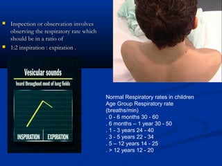    Inspection or observation involves
    observing the respiratory rate which
    should be in a ratio of
   1:2 inspiration : expiration .




                                           Normal Respiratory rates in children
                                           Age Group Respiratory rate
                                           (breaths/min)
                                           . 0 - 6 months 30 - 60
                                           . 6 months – 1 year 30 - 50
                                           . 1 - 3 years 24 - 40
                                           . 3 - 5 years 22 - 34
                                           . 5 – 12 years 14 - 25
                                           . > 12 years 12 - 20
 