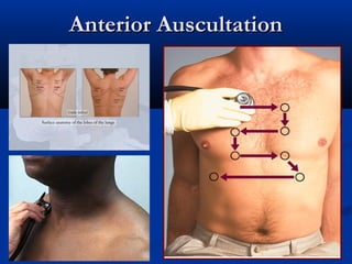 Anterior Auscultation
 