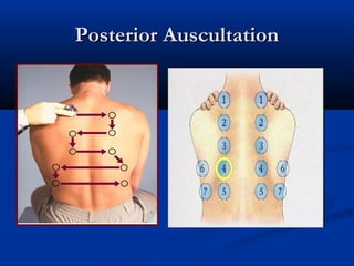Posterior Auscultation
 