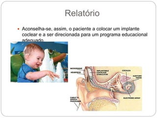 Relatório
 Aconselha-se, assim, o paciente a colocar um implante
coclear e a ser direcionada para um programa educacional
adequado.
 