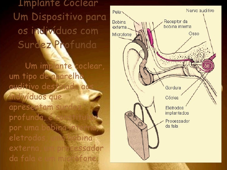 Cesgranrio Na Especie Humana Ha Um Tipo De Surdez