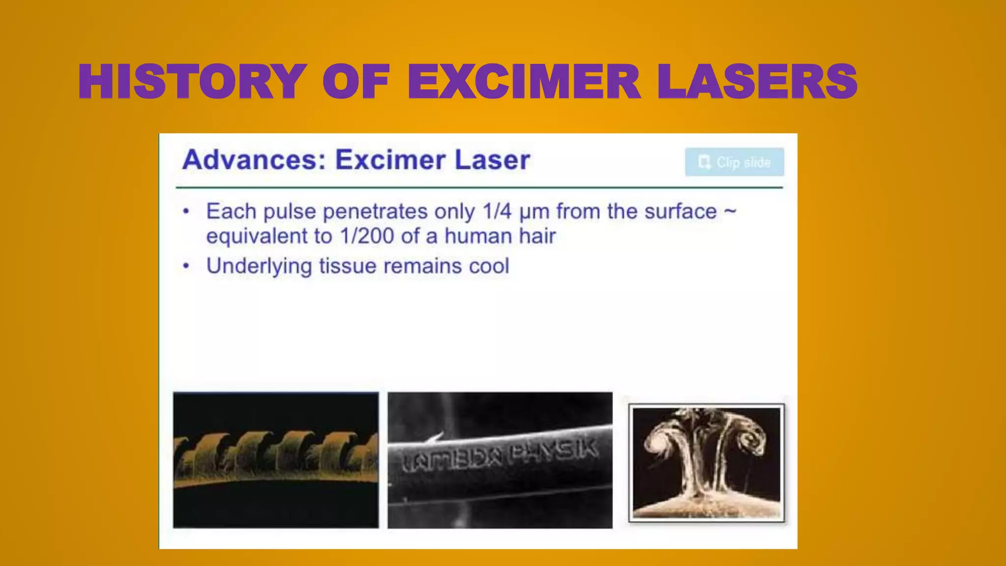 HISTORY OF EXCIMER LASERS
 