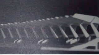 SURFACE ACTIVE STRUCTURES(structure systems) | PPTX