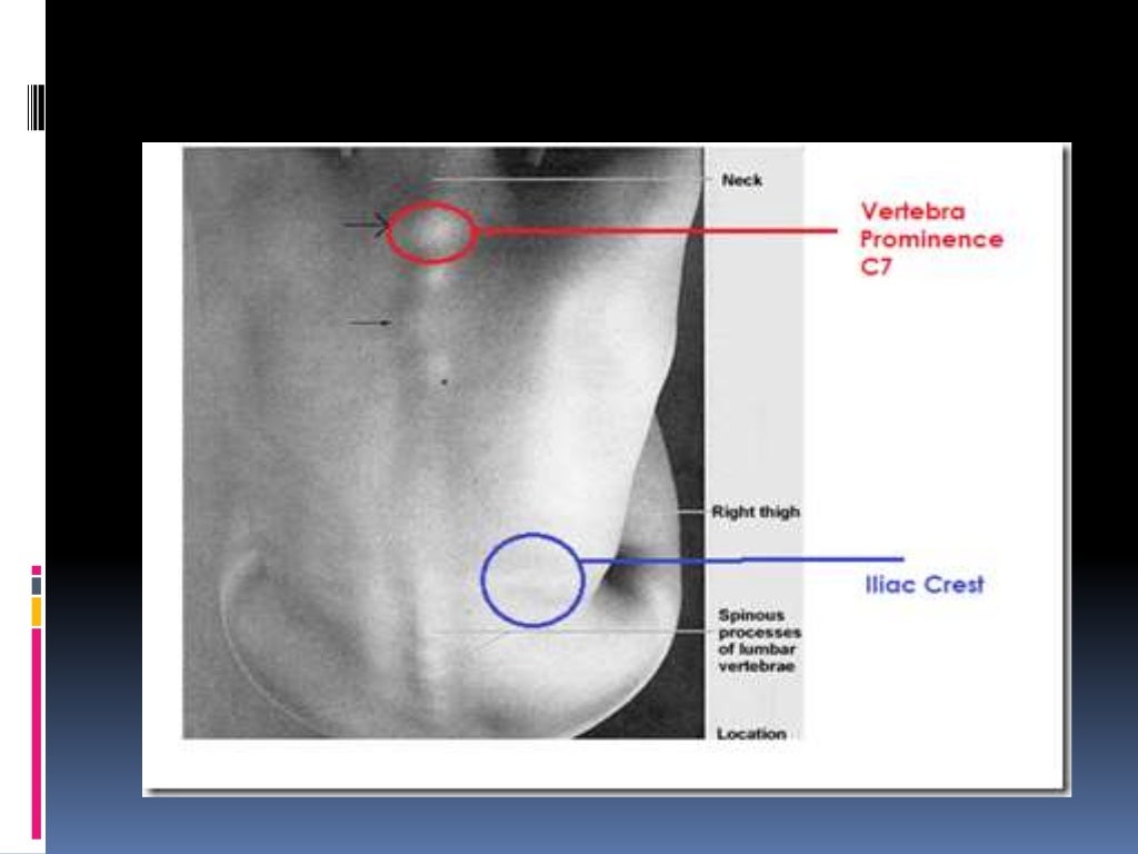 Surface anatomy