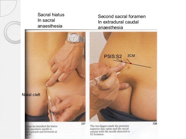 surface anatomy of lower limb surface anatomy