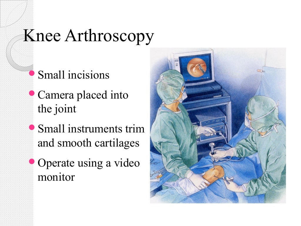 Surface anatomy of lower limb