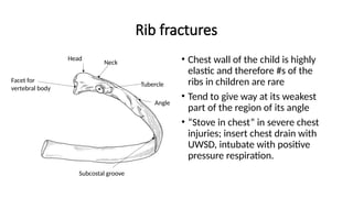 What Is Rib Compression Normal Surface Anatomy of The Chest.pptx