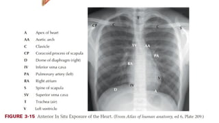 Normal Surface Anatomy of The Chest.pptx