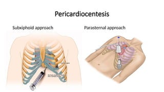 Paraxiphoid Normal Surface Anatomy of The Chest.pptx