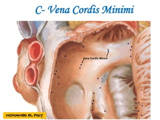Vena Cordis Minimi
C- Vena Cordis Minimi
 