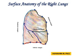 Posteriormargin
Inferior margin
Horizontal fissure
Surface Anatomy of the Right Lungs
 