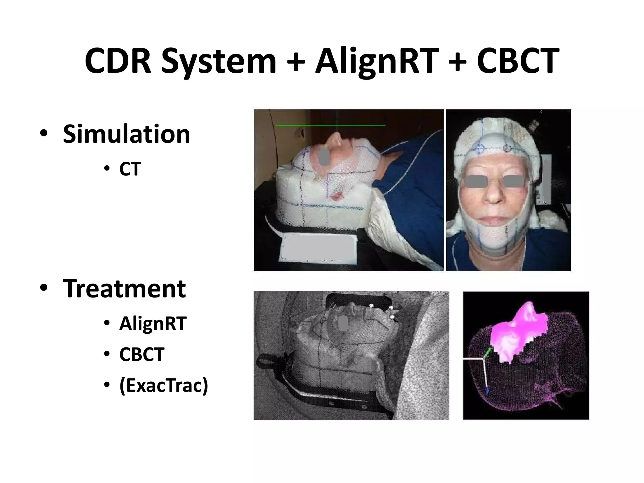 CDR System + AlignRT + CBCT
• Simulation
• CT
• Treatment
• AlignRT
• CBCT
• (ExacTrac)
 