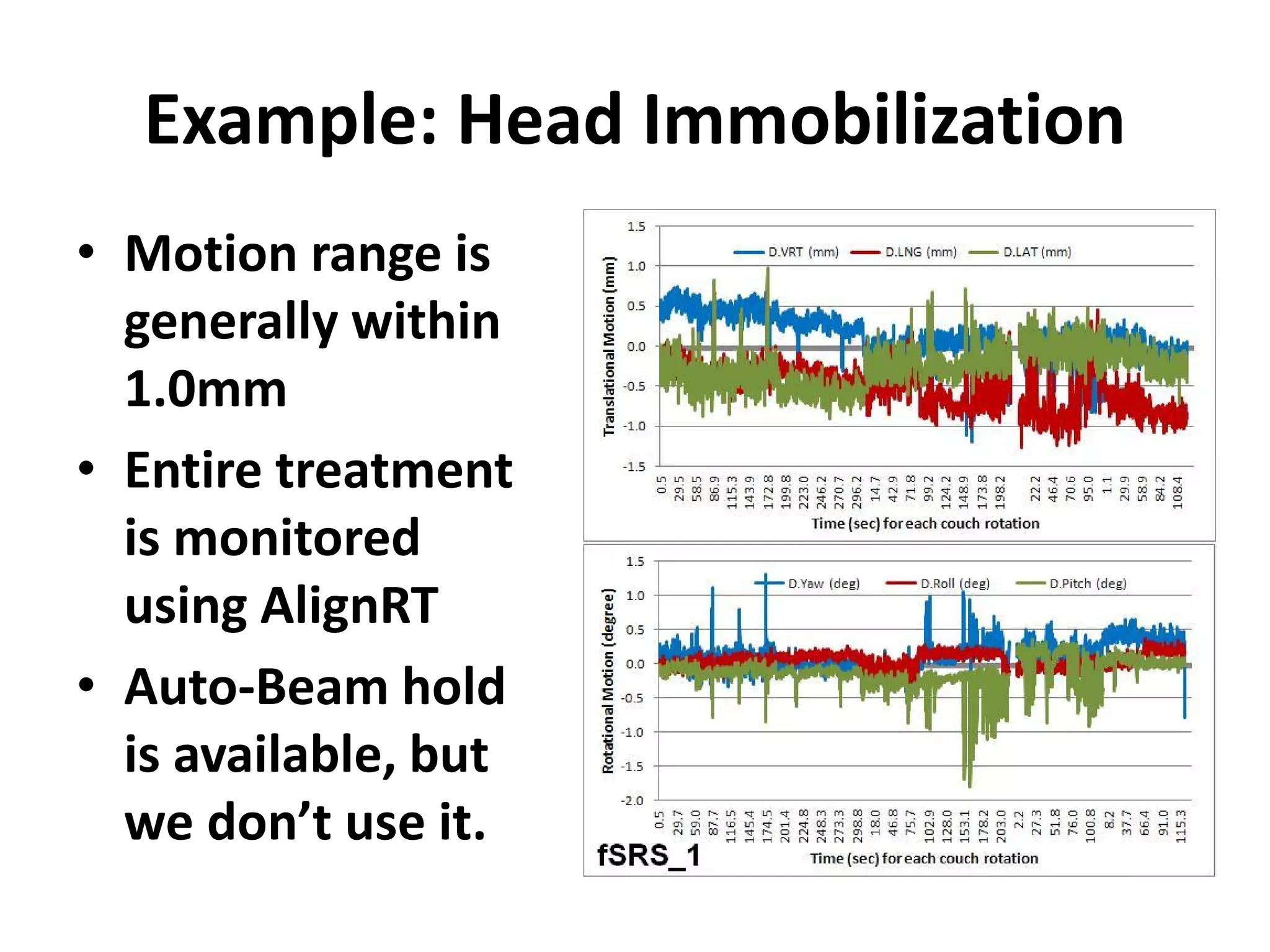 Example: Head Immobilization
• Motion range is
generally within
1.0mm
• Entire treatment
is monitored
using AlignRT
• Auto-Beam hold
is available, but
we don’t use it.
 