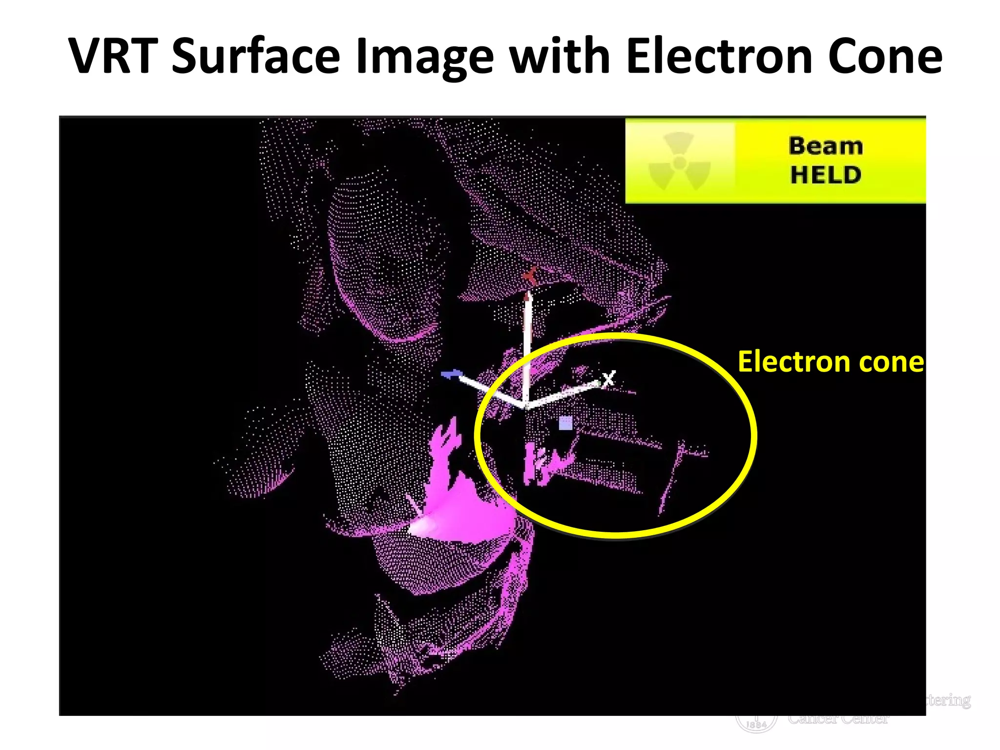 6/29/2016 28
VRT Surface Image with Electron Cone
Electron cone
 