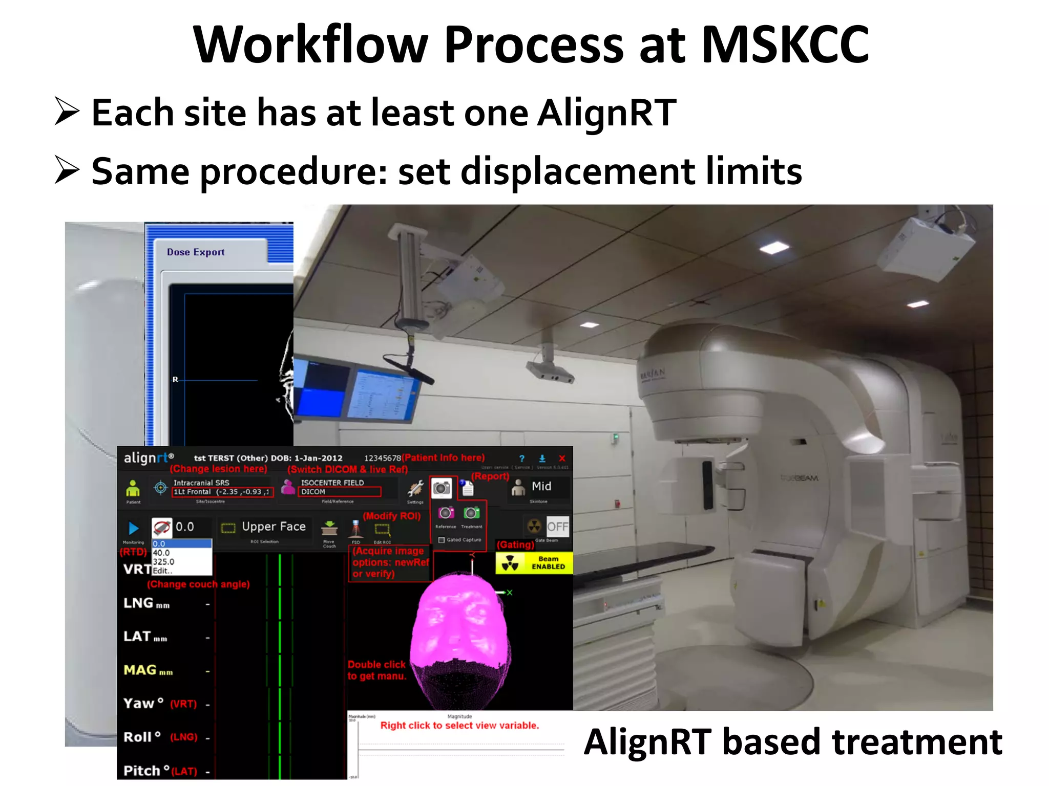 Workflow Process at MSKCC
3
 Each site has at least one AlignRT
 Same procedure: set displacement limits
CT SIM with immobilization
iPlan
AlignRT based treatment
 