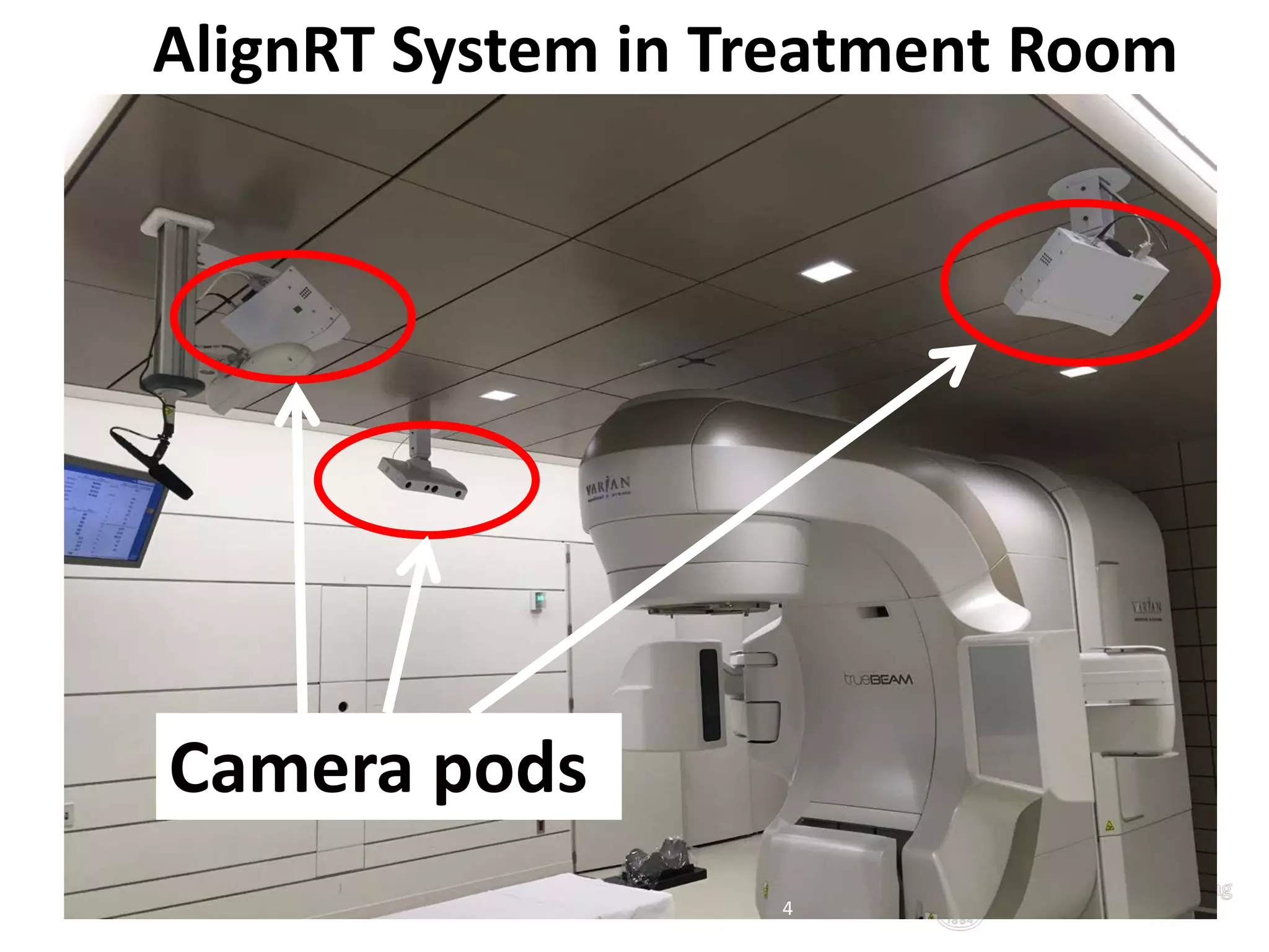 AlignRT System in Treatment Room
4
Camera pods
 