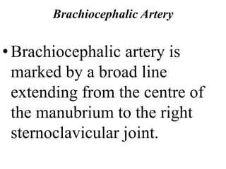 Brachiocephalic Artery
•Brachiocephalic artery is
marked by a broad line
extending from the centre of
the manubrium to the right
sternoclavicular joint.
 