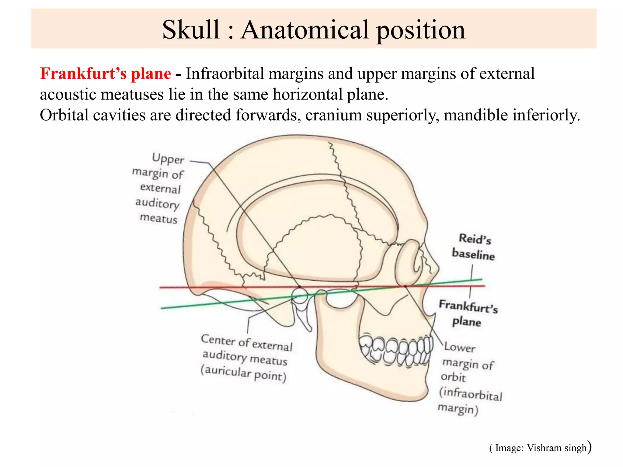 The Anatomy of the FPM Impersonation Scam