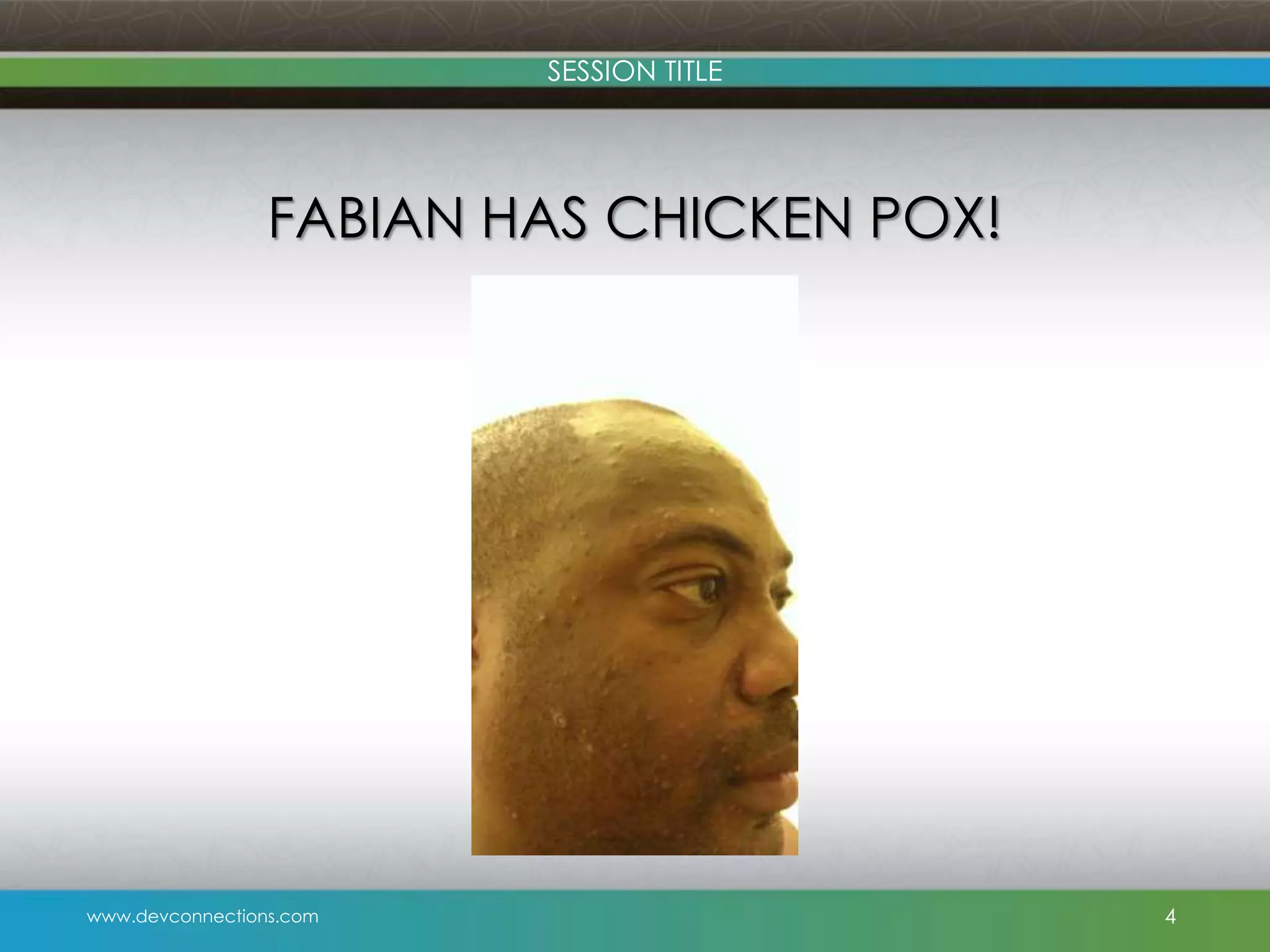 SESSION TITLE FABIAN HAS CHICKEN POX! www.devconnections.com 4 