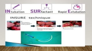 Surfent Injection Surfactant therapy |medical administration of exogenous surfactant | PPTX