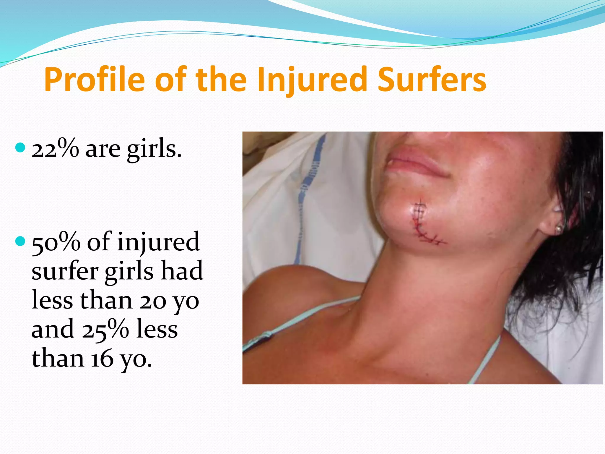 Profile of the Injured Surfers
 22% are girls.
 50% of injured
surfer girls had
less than 20 yo
and 25% less
than 16 yo.
 