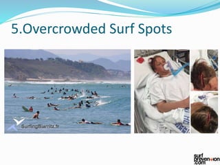 5.Overcrowded Surf Spots
 