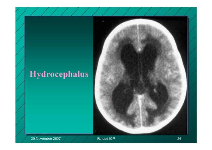 Surg351 presentation and management of raised intracranial pressure