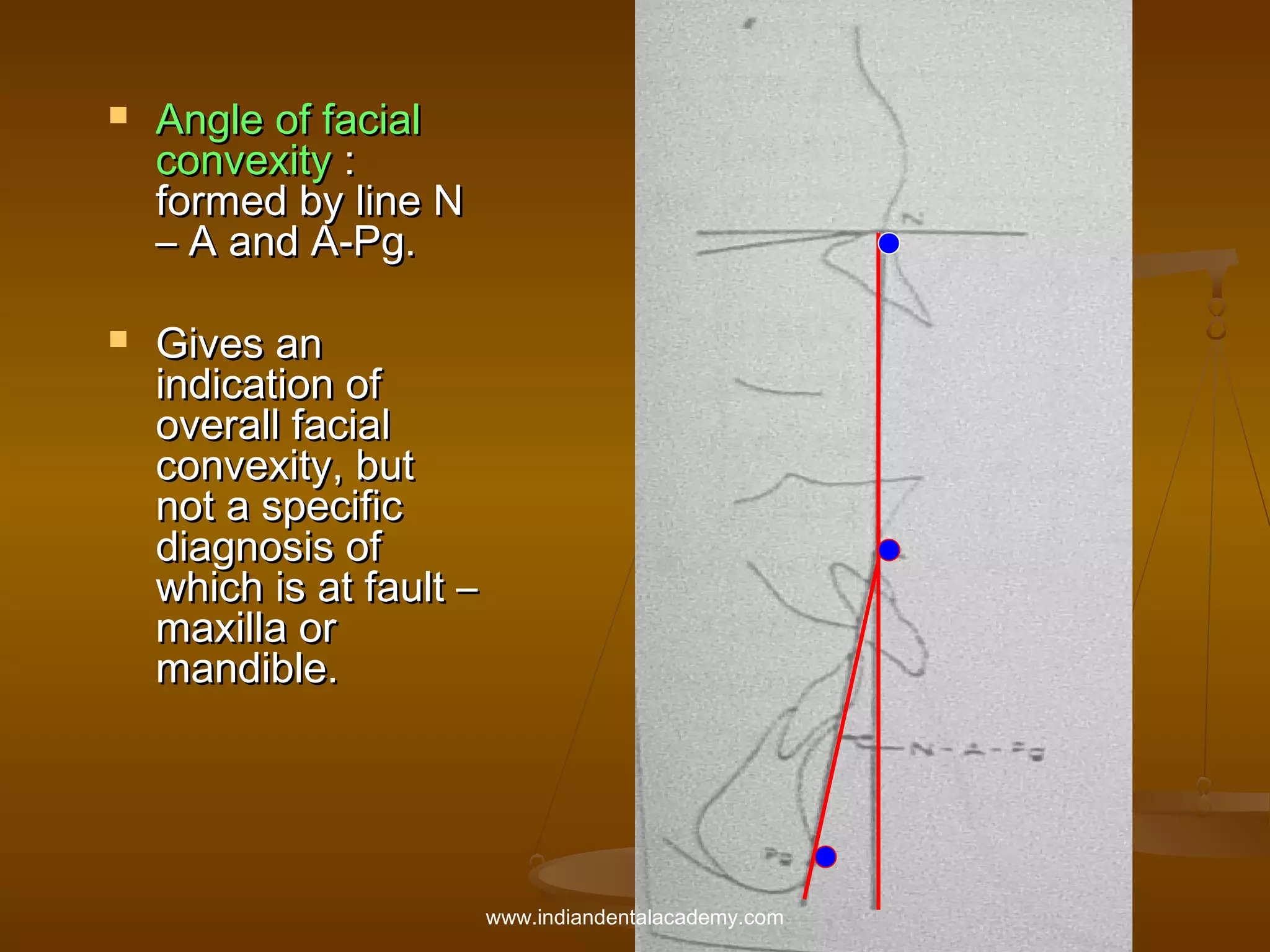 



Angle of facial
convexity :
formed by line N
– A and A-Pg.
Gives an
indication of
overall facial
convexity, but
not a specific
diagnosis of
which is at fault –
maxilla or
mandible.

www.indiandentalacademy.com

 