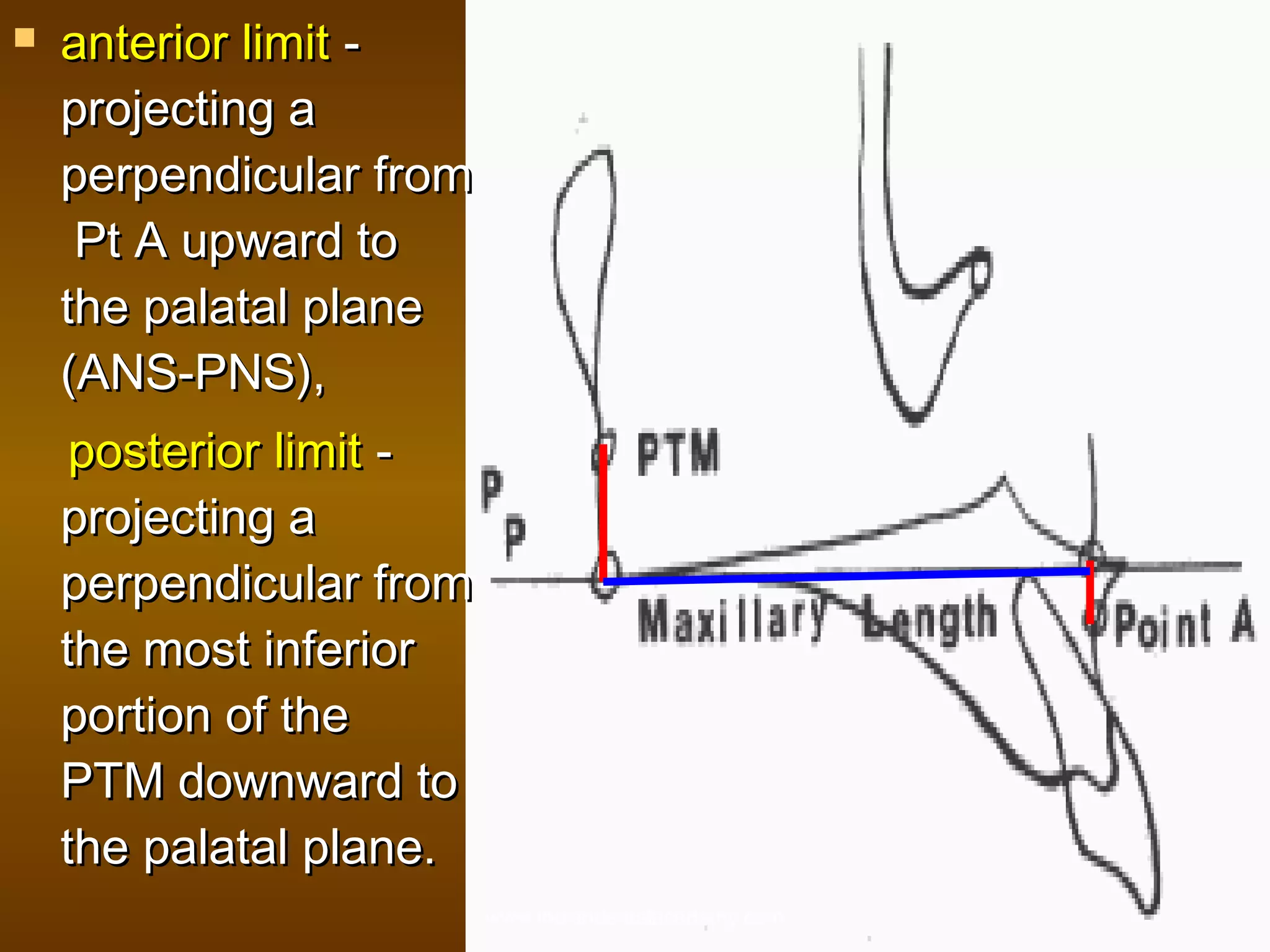 

anterior limit projecting a
perpendicular from
Pt A upward to
the palatal plane
(ANS-PNS),
posterior limit projecting a
perpendicular from
the most inferior
portion of the
PTM downward to
the palatal plane.
www.indiandentalacademy.com

 