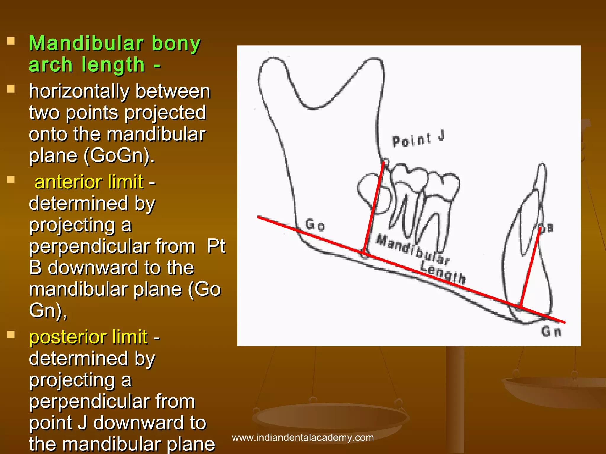 







Mandibular bony
arch length horizontally between
two points projected
onto the mandibular
plane (GoGn).
anterior limit determined by
projecting a
perpendicular from Pt
B downward to the
mandibular plane (Go
Gn),
posterior limit determined by
projecting a
perpendicular from
point J downward to
the mandibular plane www.indiandentalacademy.com

 