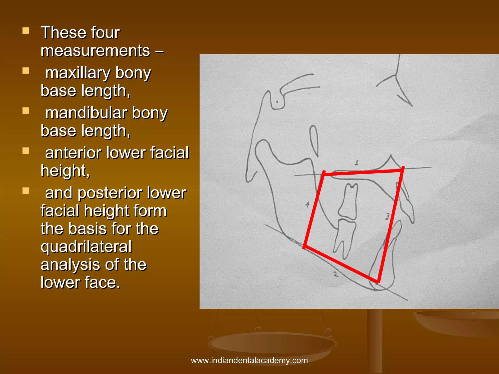 









These four
measurements –
maxillary bony
base length,
mandibular bony
base length,
anterior lower facial
height,
and posterior lower
facial height form
the basis for the
quadrilateral
analysis of the
lower face.

www.indiandentalacademy.com

 