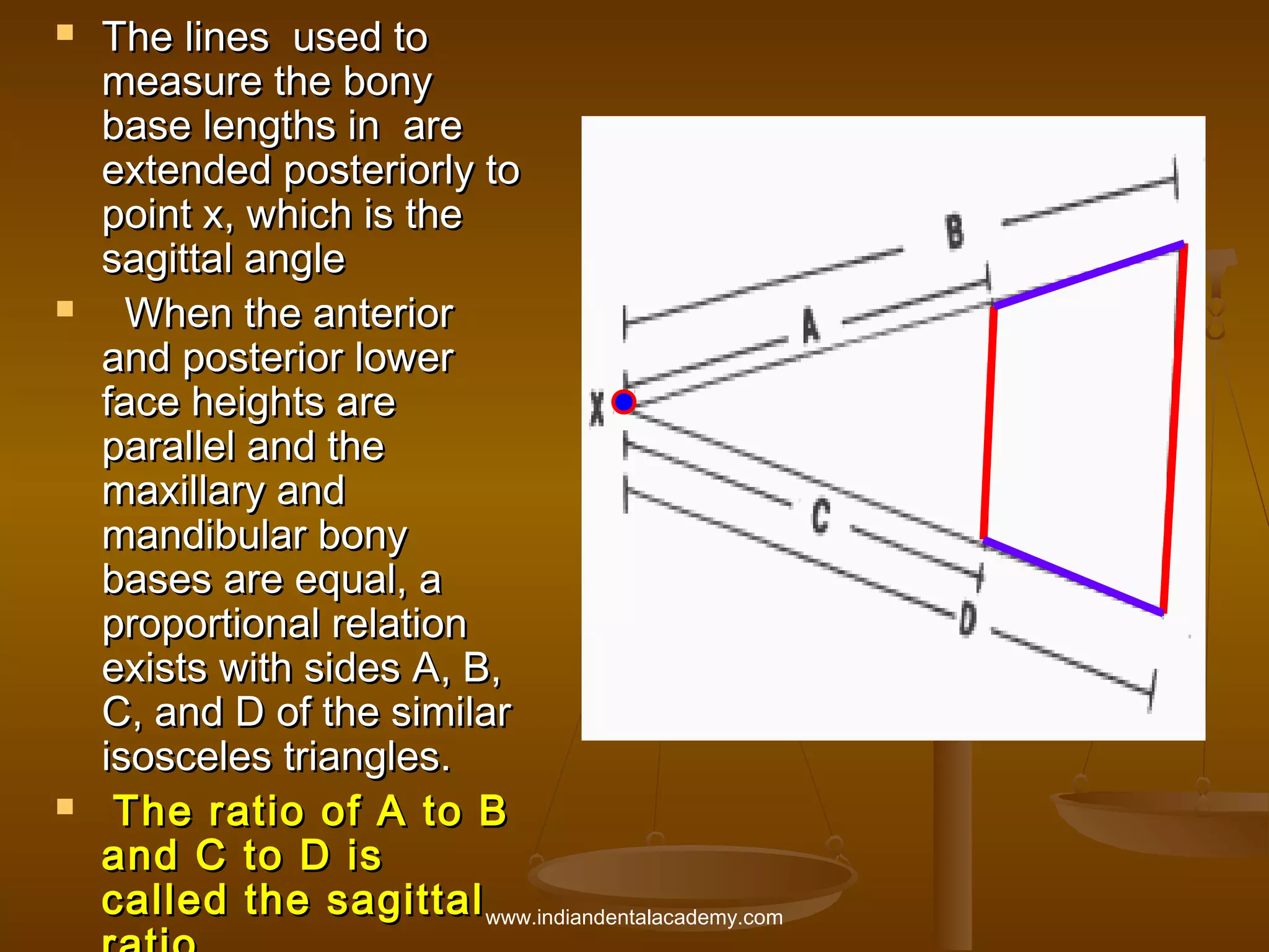 





The lines used to
measure the bony
base lengths in are
extended posteriorly to
point x, which is the
sagittal angle
When the anterior
and posterior lower
face heights are
parallel and the
maxillary and
mandibular bony
bases are equal, a
proportional relation
exists with sides A, B,
C, and D of the similar
isosceles triangles.
The ratio of A to B
and C to D is
called the sagittal www.indiandentalacademy.com

 
