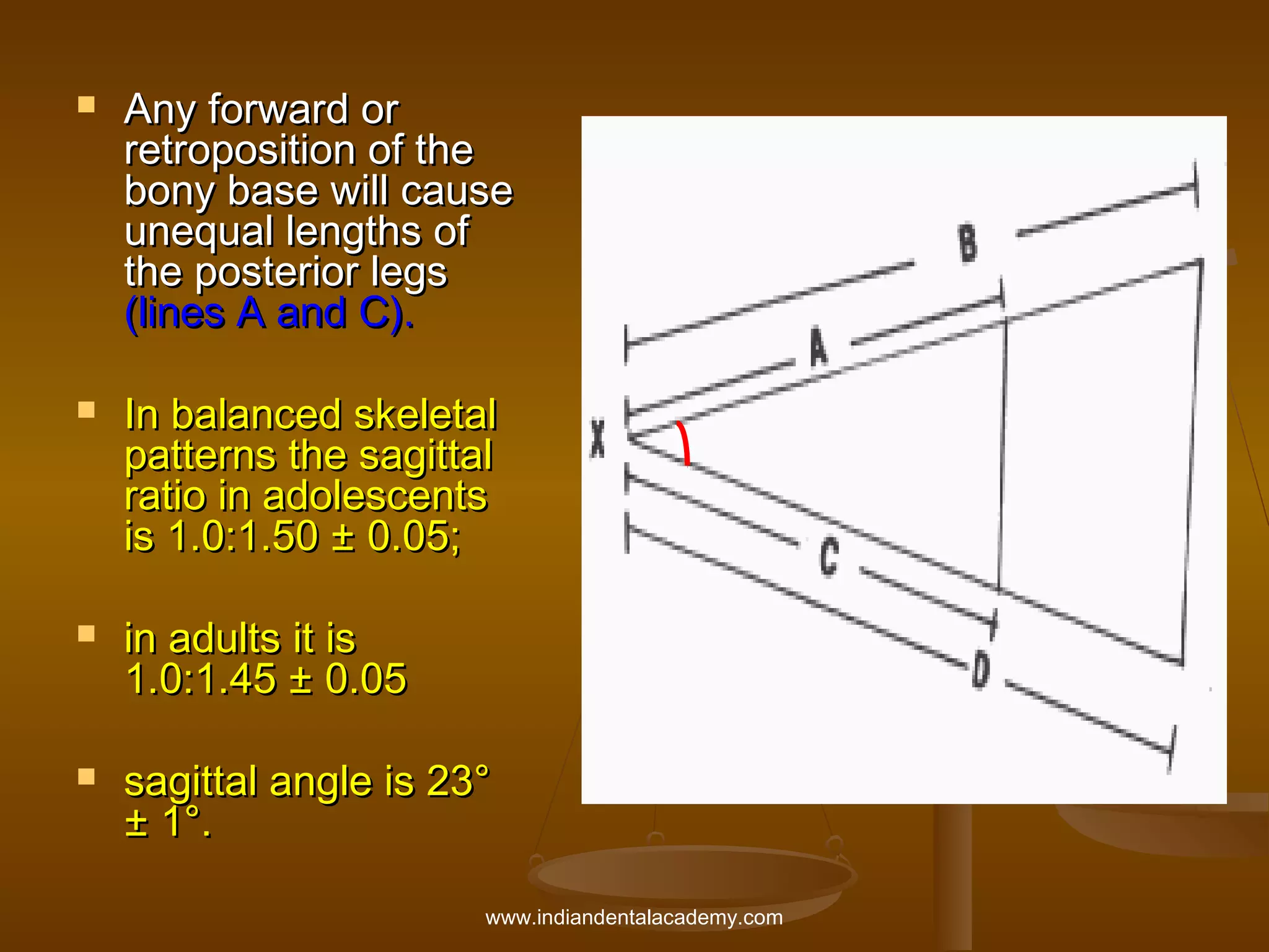 







Any forward or
retroposition of the
bony base will cause
unequal lengths of
the posterior legs
(lines A and C).
In balanced skeletal
patterns the sagittal
ratio in adolescents
is 1.0:1.50 ± 0.05;
in adults it is
1.0:1.45 ± 0.05
sagittal angle is 23°
± 1°.
www.indiandentalacademy.com

 