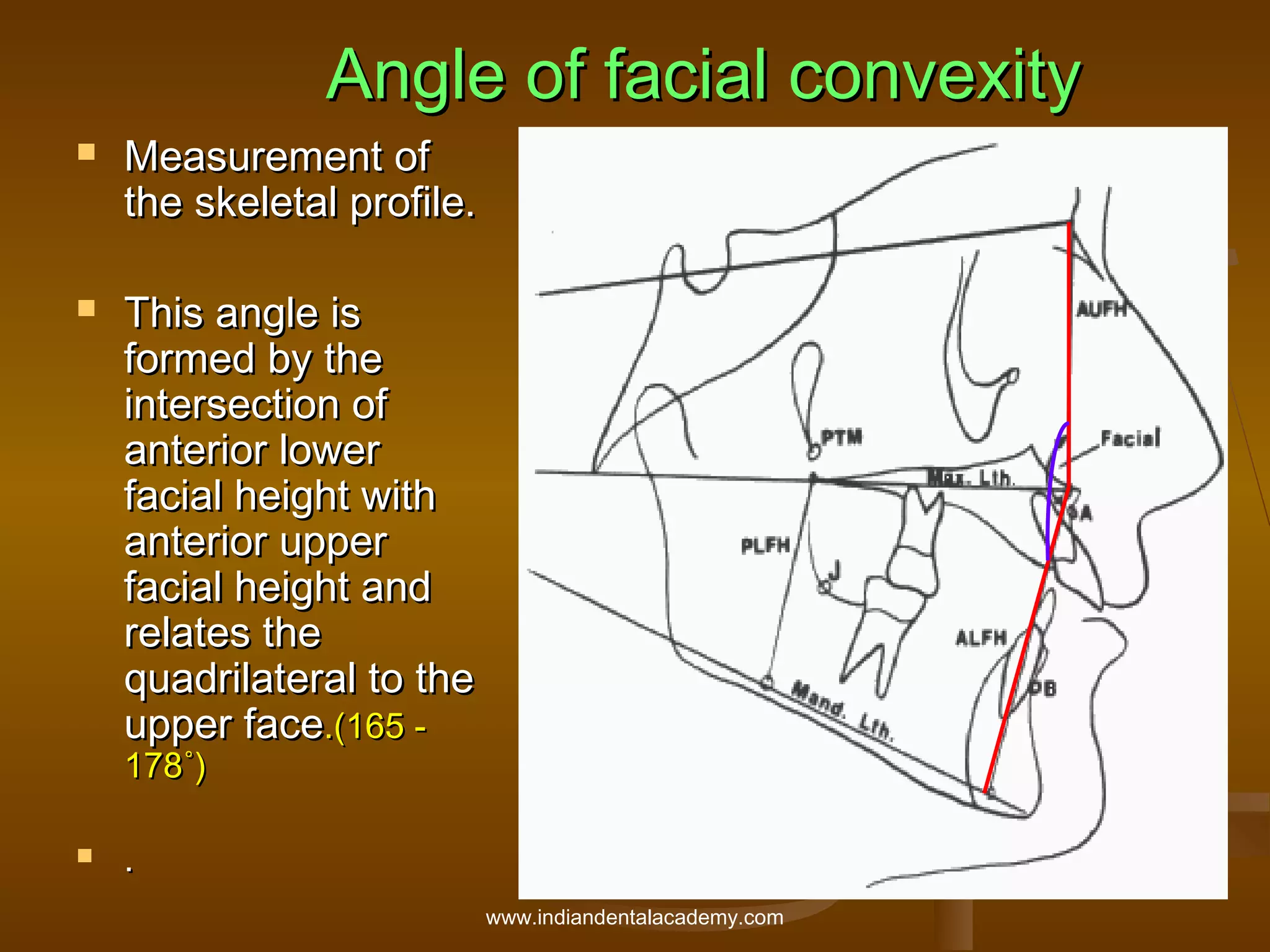 Angle of facial convexity




Measurement of
the skeletal profile.
This angle is
formed by the
intersection of
anterior lower
facial height with
anterior upper
facial height and
relates the
quadrilateral to the
upper face.(165 178˚)



.
www.indiandentalacademy.com

 