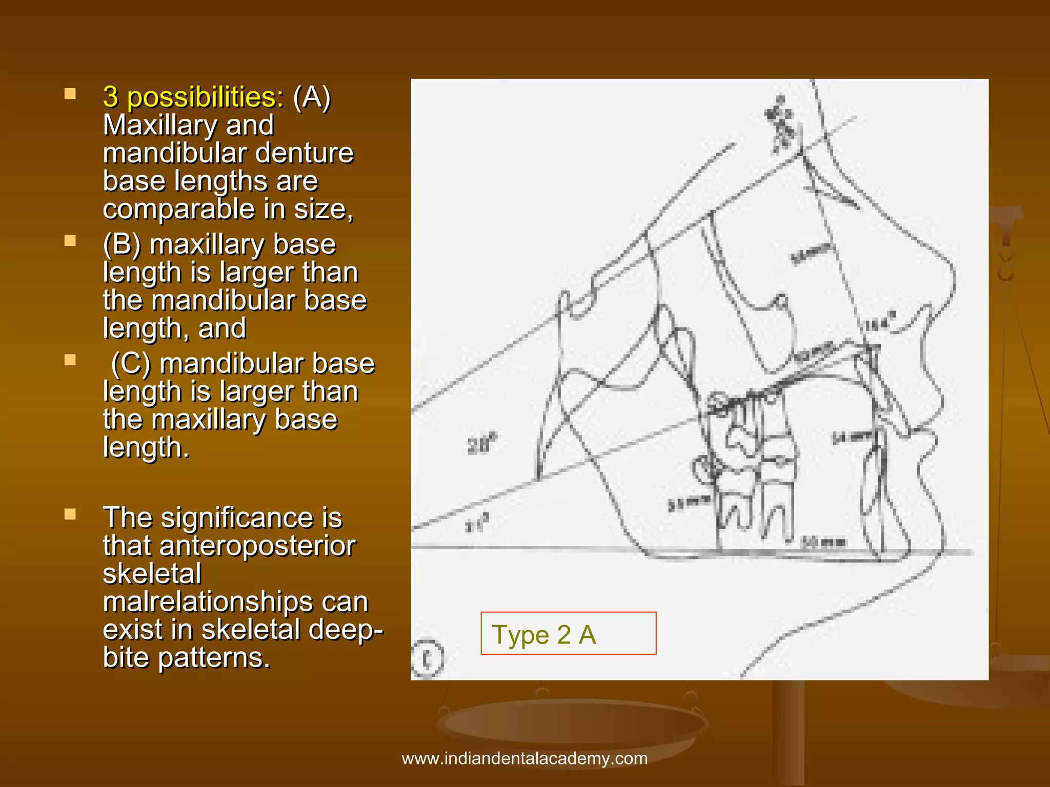 







3 possibilities: (A)
Maxillary and
mandibular denture
base lengths are
comparable in size,
(B) maxillary base
length is larger than
the mandibular base
length, and
(C) mandibular base
length is larger than
the maxillary base
length.
The significance is
that anteroposterior
skeletal
malrelationships can
exist in skeletal deepbite patterns.

Type 2 A

www.indiandentalacademy.com

 
