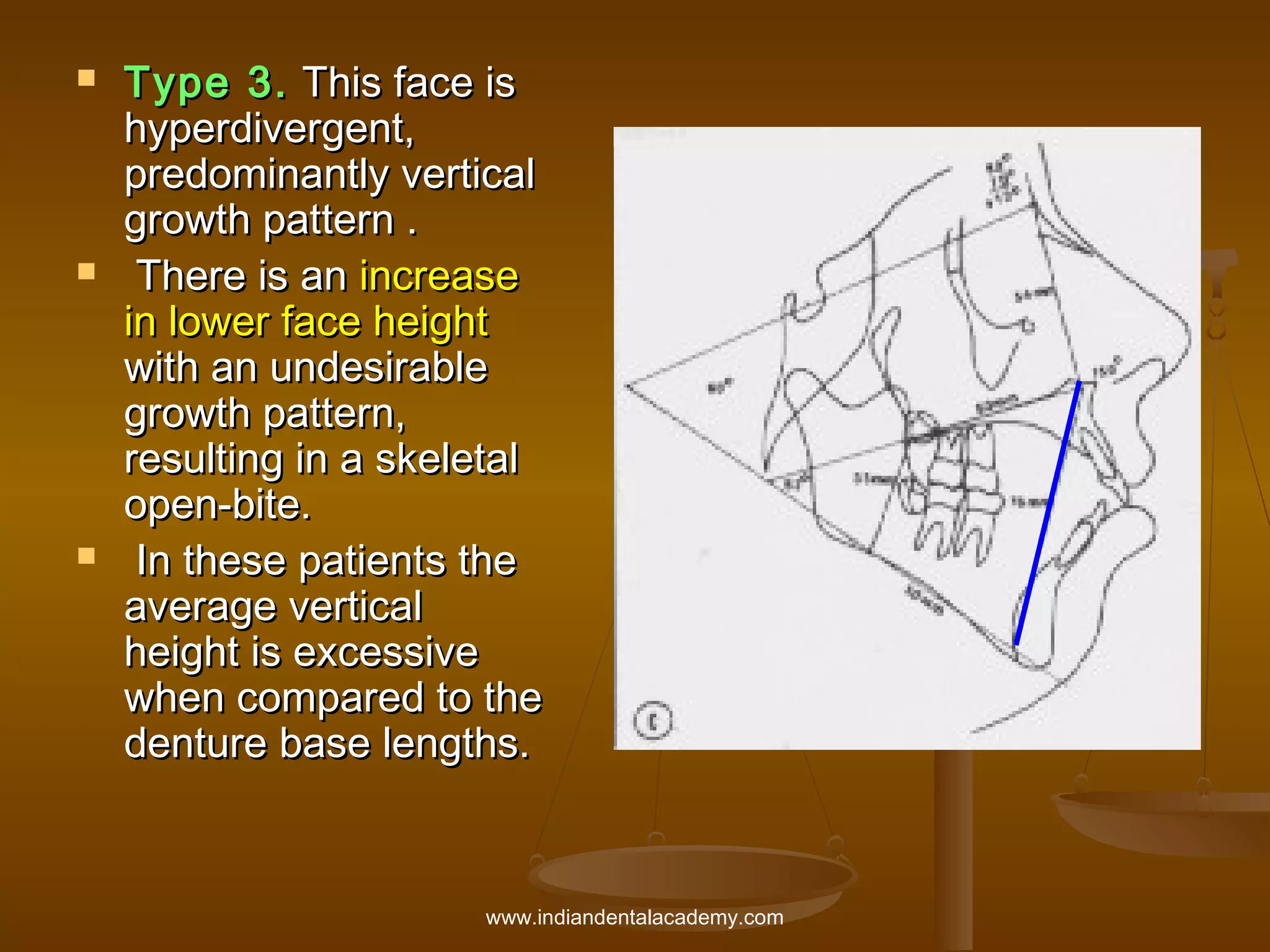 





Type 3. This face is
hyperdivergent,
predominantly vertical
growth pattern .
There is an increase
in lower face height
with an undesirable
growth pattern,
resulting in a skeletal
open-bite.
In these patients the
average vertical
height is excessive
when compared to the
denture base lengths.

www.indiandentalacademy.com

 