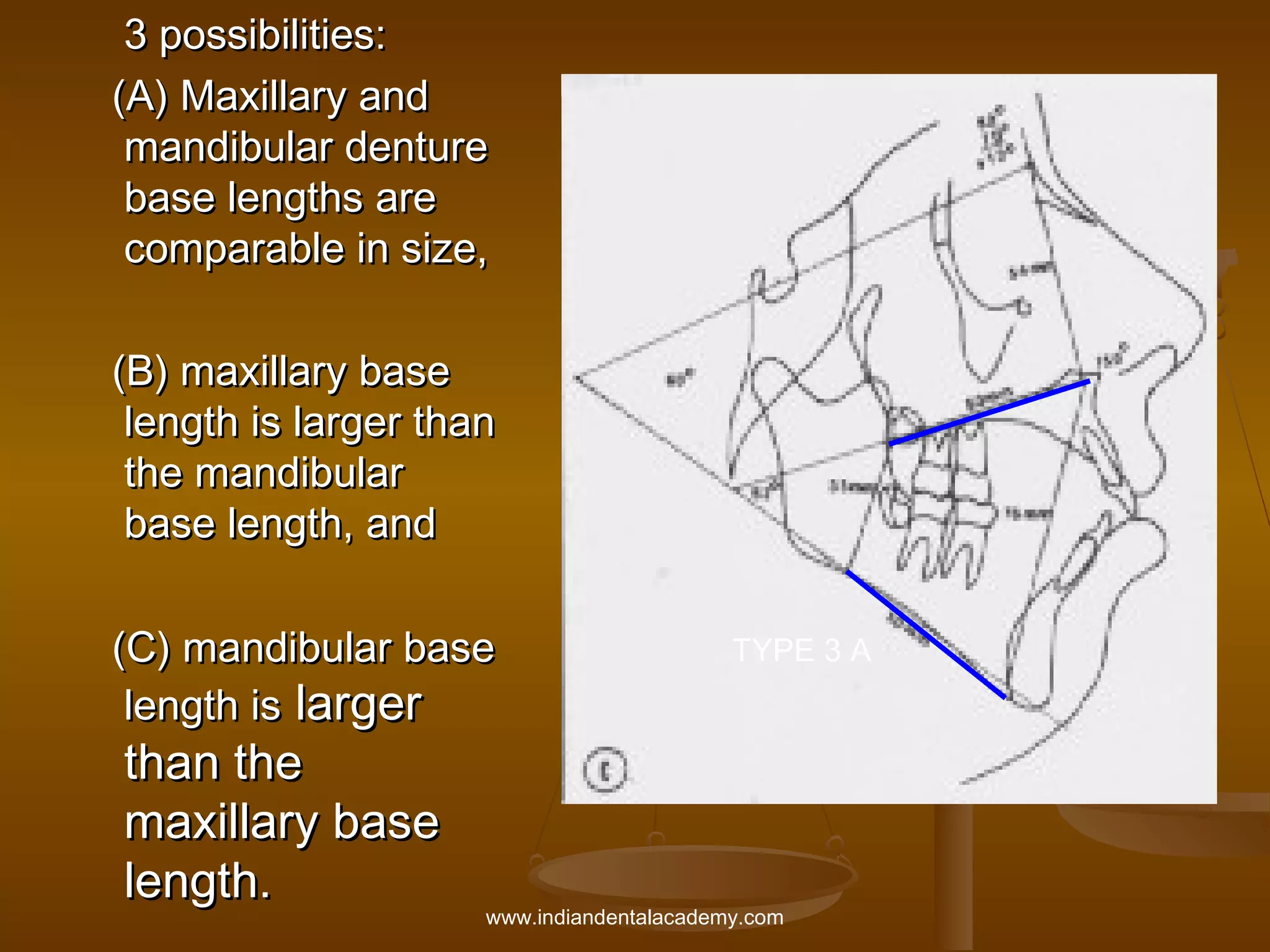 3 possibilities:
(A) Maxillary and
mandibular denture
base lengths are
comparable in size,
(B) maxillary base
length is larger than
the mandibular
base length, and
(C) mandibular base
length is larger

than the
maxillary base
length.

TYPE 3 A

www.indiandentalacademy.com

 