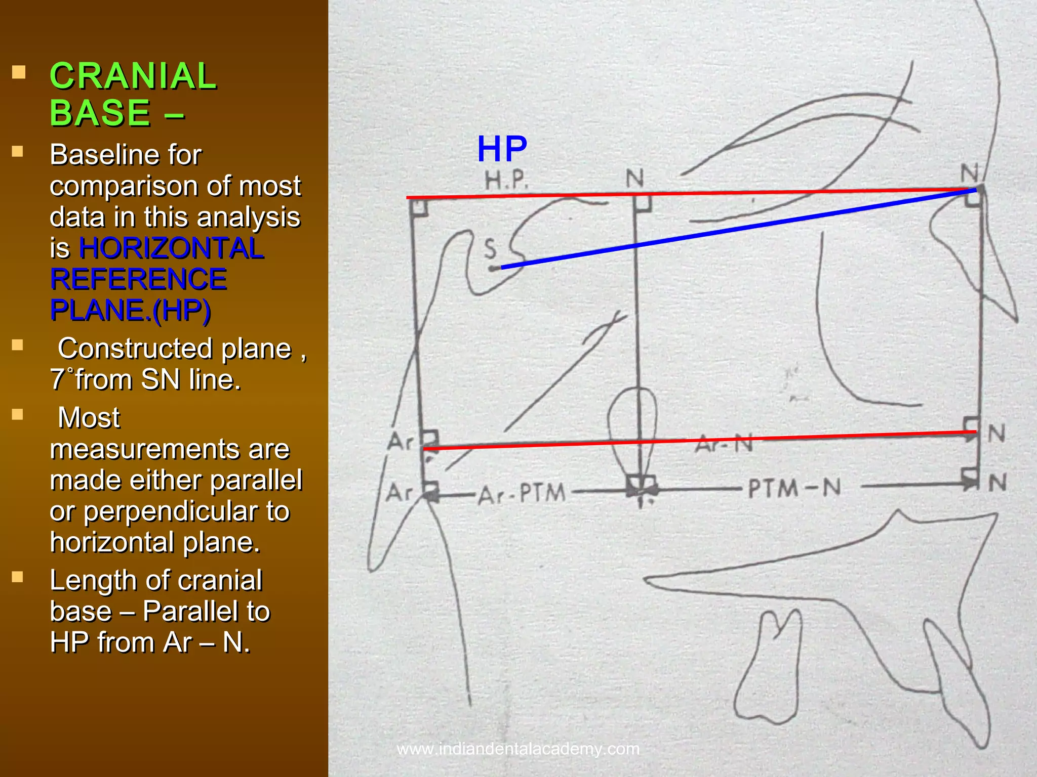 









CRANIAL
BASE –

Baseline for
comparison of most
data in this analysis
is HORIZONTAL
REFERENCE
PLANE.(HP)
Constructed plane ,
7˚from SN line.
Most
measurements are
made either parallel
or perpendicular to
horizontal plane.
Length of cranial
base – Parallel to
HP from Ar – N.

HP

www.indiandentalacademy.com

 