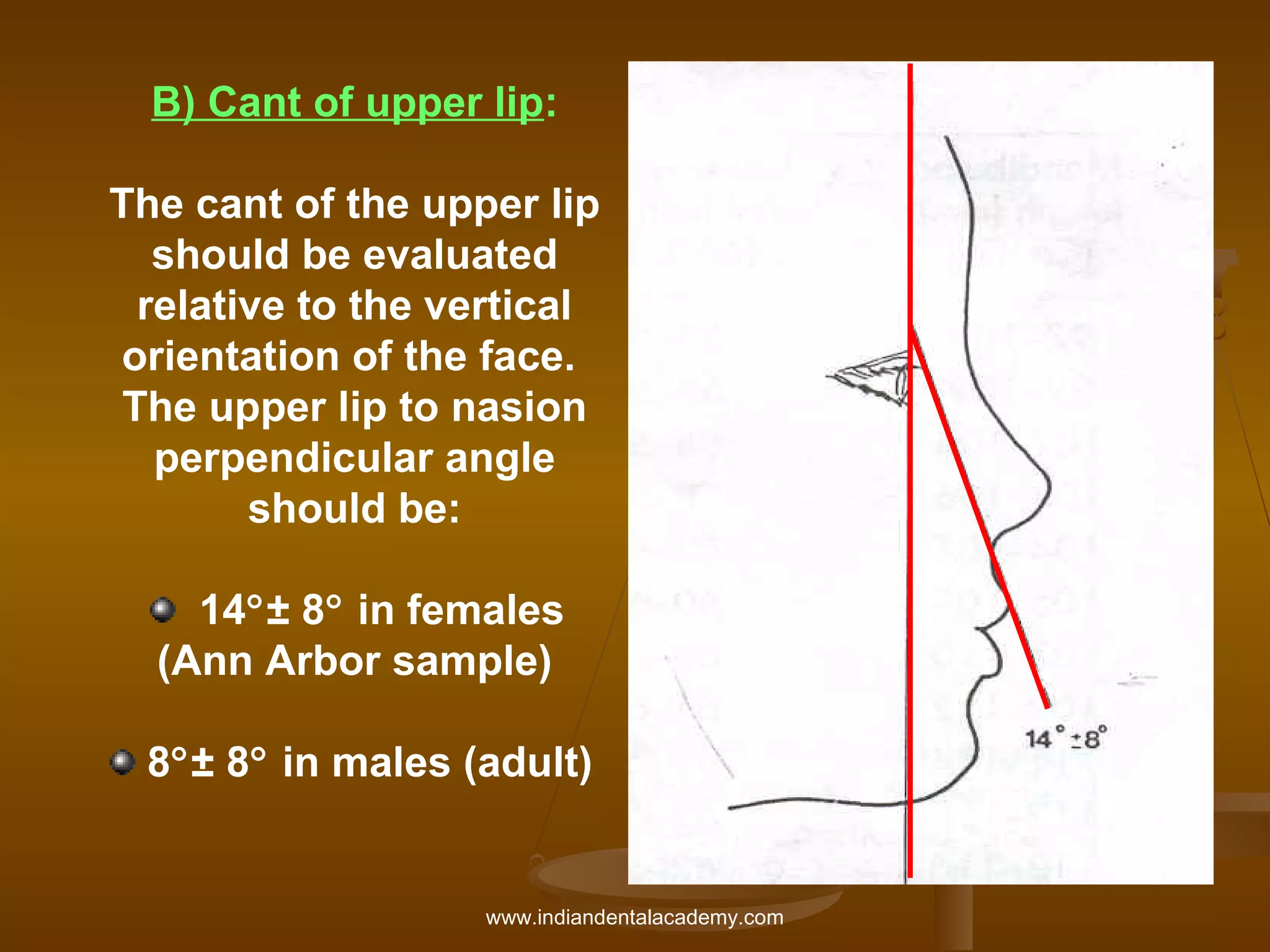 B) Cant of upper lip:
The cant of the upper lip
should be evaluated
relative to the vertical
orientation of the face.
The upper lip to nasion
perpendicular angle
should be:
14°± 8° in females
(Ann Arbor sample)
8°± 8° in males (adult)

www.indiandentalacademy.com

 