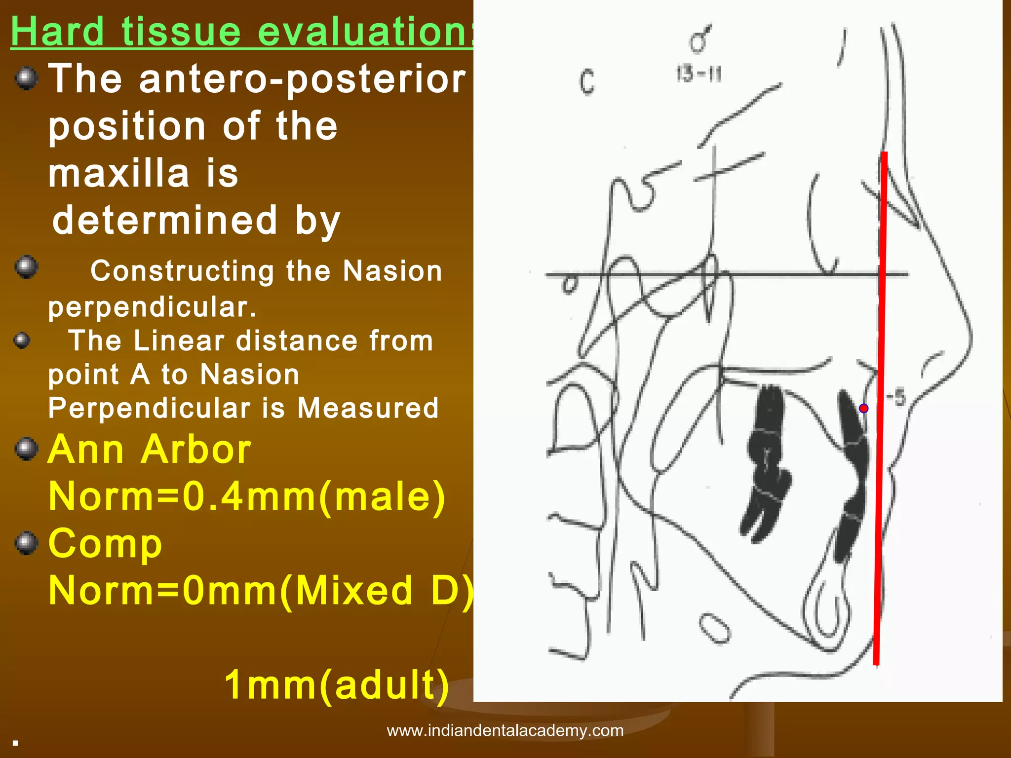Hard tissue evaluation:
The antero-posterior
position of the
maxilla is
determined by
Constructing the Nasion
perpendicular.
The Linear distance from
point A to Nasion
Perpendicular is Measured

Ann Arbor
Norm=0.4mm(male)
Comp
Norm=0mm(Mixed D)
.

1mm(adult)
www.indiandentalacademy.com

 