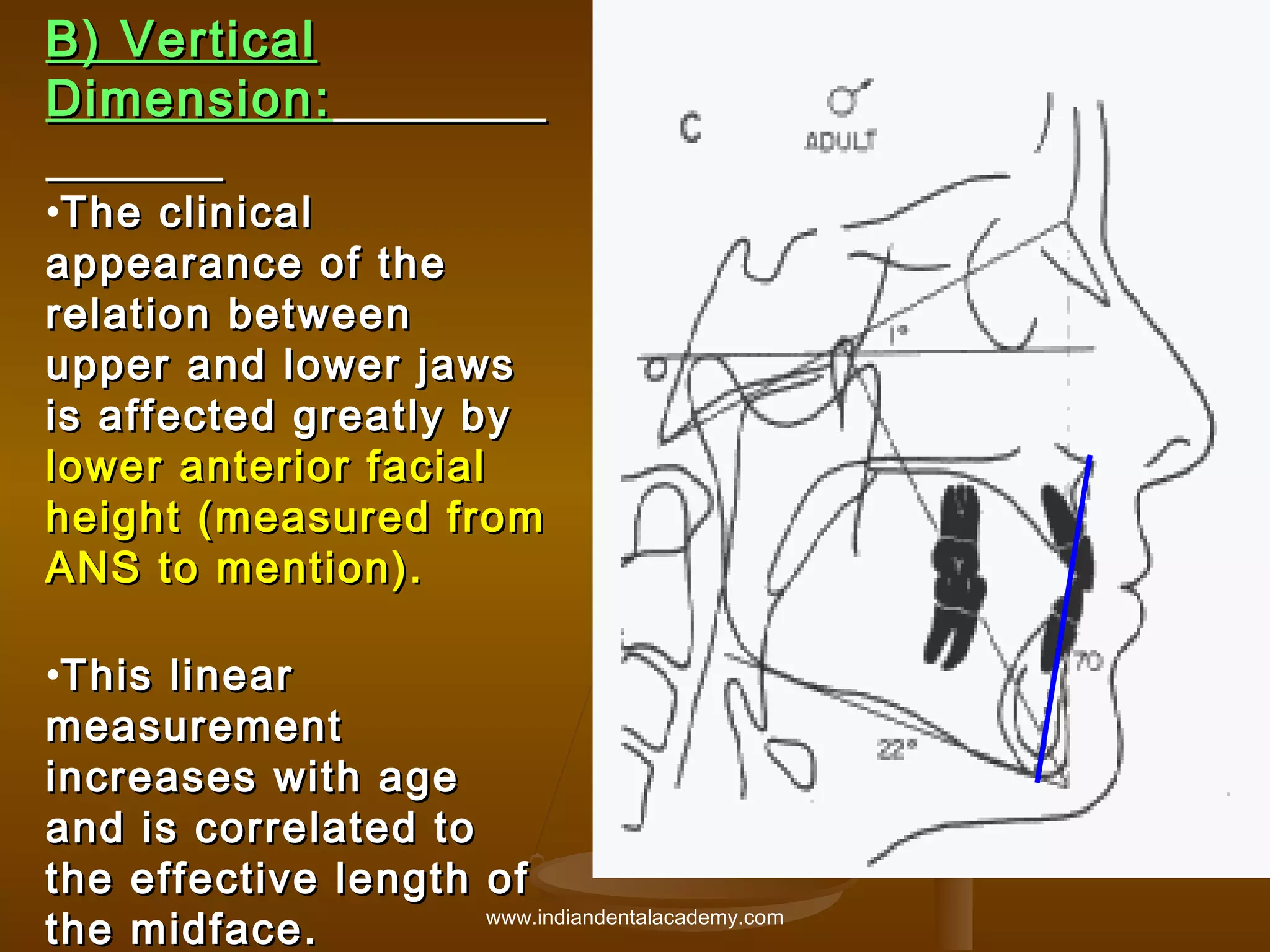 B) Vertical
Dimension:
•The clinical
appearance of the
relation between
upper and lower jaws
is affected greatly by
lower anterior facial
height (measured from
ANS to mention).
•This linear
measurement
increases with age
and is correlated to
the effective length of
www.indiandentalacademy.com
the midface .

 