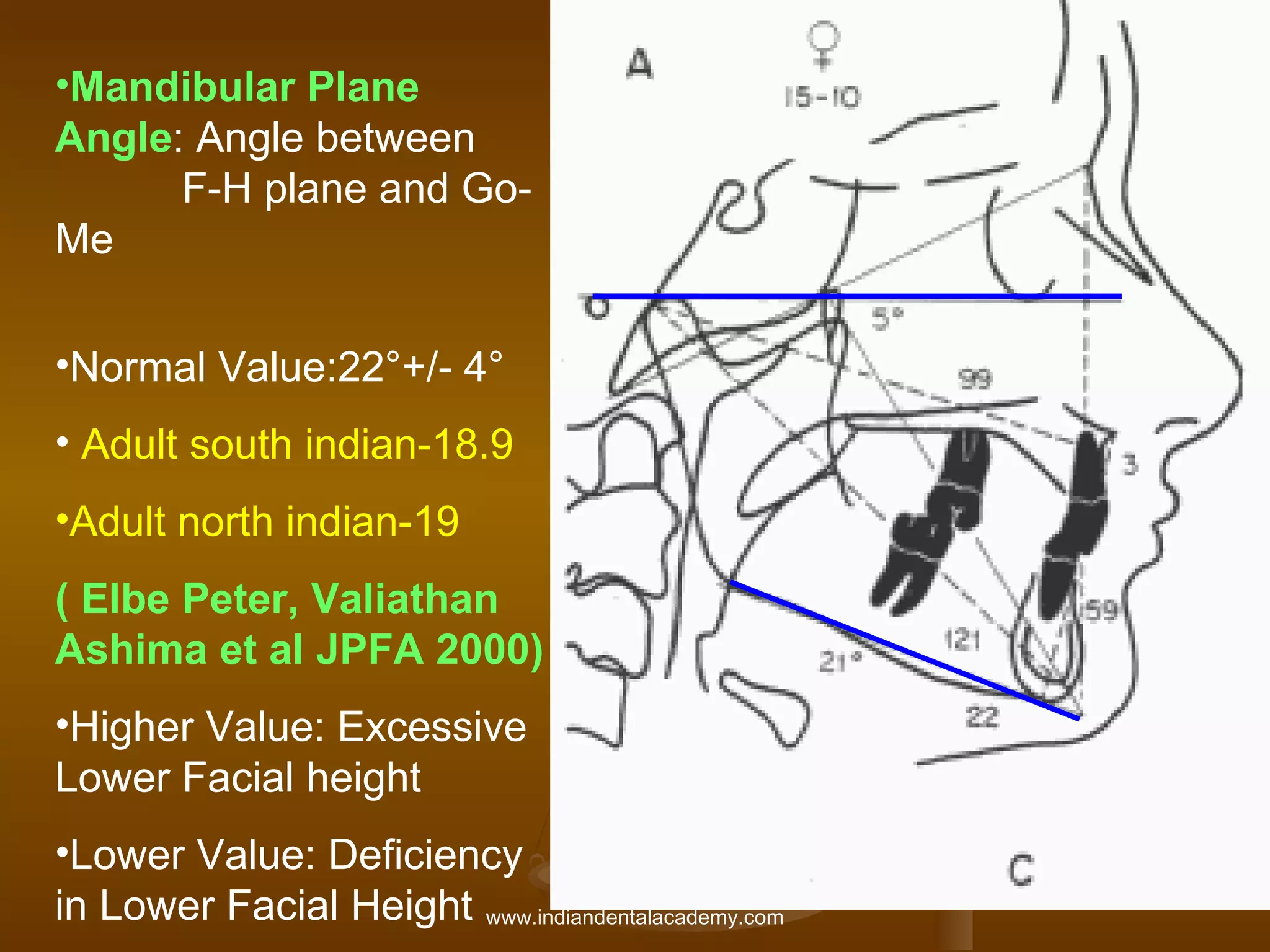 •Mandibular Plane
Angle: Angle between
F-H plane and GoMe
•Normal Value:22°+/- 4°
• Adult south indian-18.9
•Adult north indian-19
( Elbe Peter, Valiathan
Ashima et al JPFA 2000)
•Higher Value: Excessive
Lower Facial height
•Lower Value: Deficiency
in Lower Facial Height www.indiandentalacademy.com

 