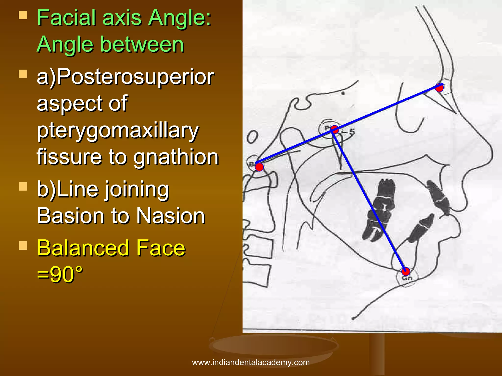 







Facial axis Angle:
Angle between
a)Posterosuperior
aspect of
pterygomaxillary
fissure to gnathion
b)Line joining
Basion to Nasion
Balanced Face
=90°

www.indiandentalacademy.com

 
