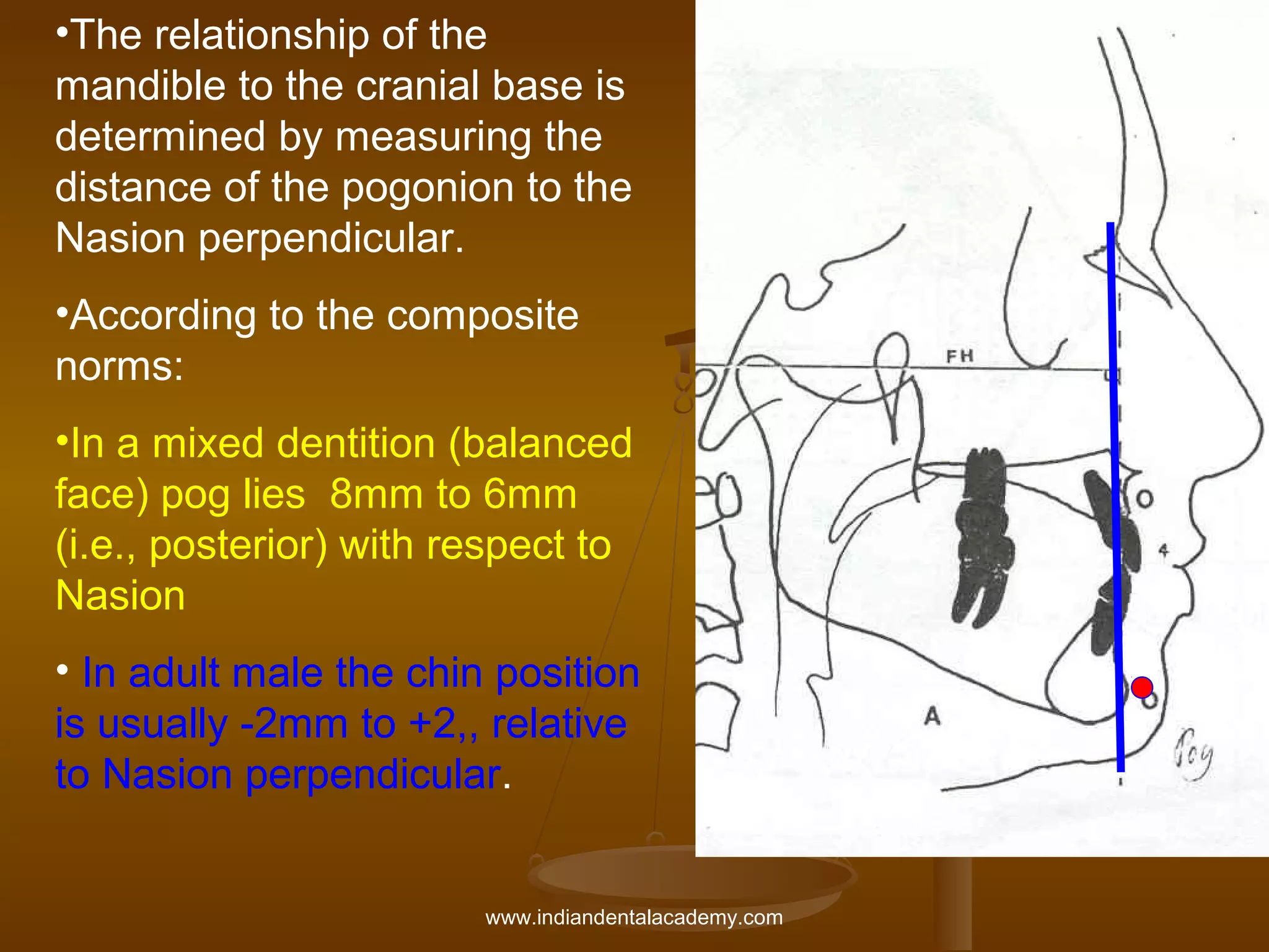 •The relationship of the
mandible to the cranial base is
determined by measuring the
distance of the pogonion to the
Nasion perpendicular.
•According to the composite
norms:
•In a mixed dentition (balanced
face) pog lies 8mm to 6mm
(i.e., posterior) with respect to
Nasion
• In adult male the chin position
is usually -2mm to +2,, relative
to Nasion perpendicular.
www.indiandentalacademy.com

 