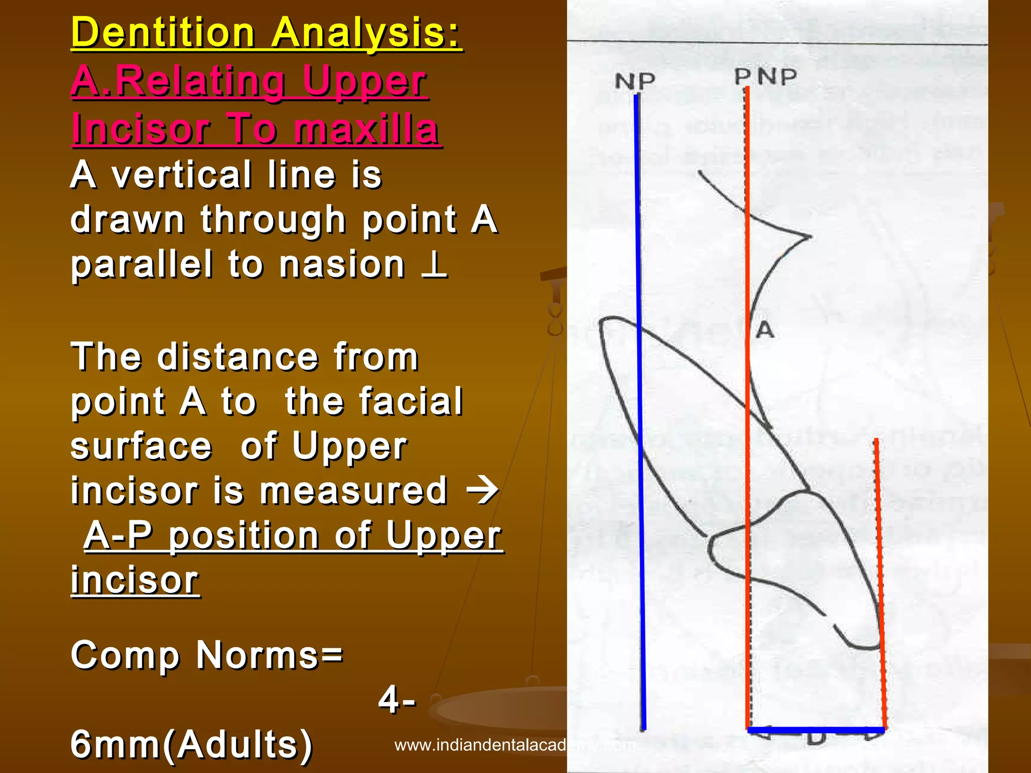 Dentition Analysis:
A.Relating Upper
Incisor To maxilla

A vertical line is
drawn through point A
parallel to nasion ⊥
The distance from
point A to the facial
surface of Upper
incisor is measured 
A-P position of Upper
incisor
Comp Norms=
6mm(Adults)

4www.indiandentalacademy.com

 