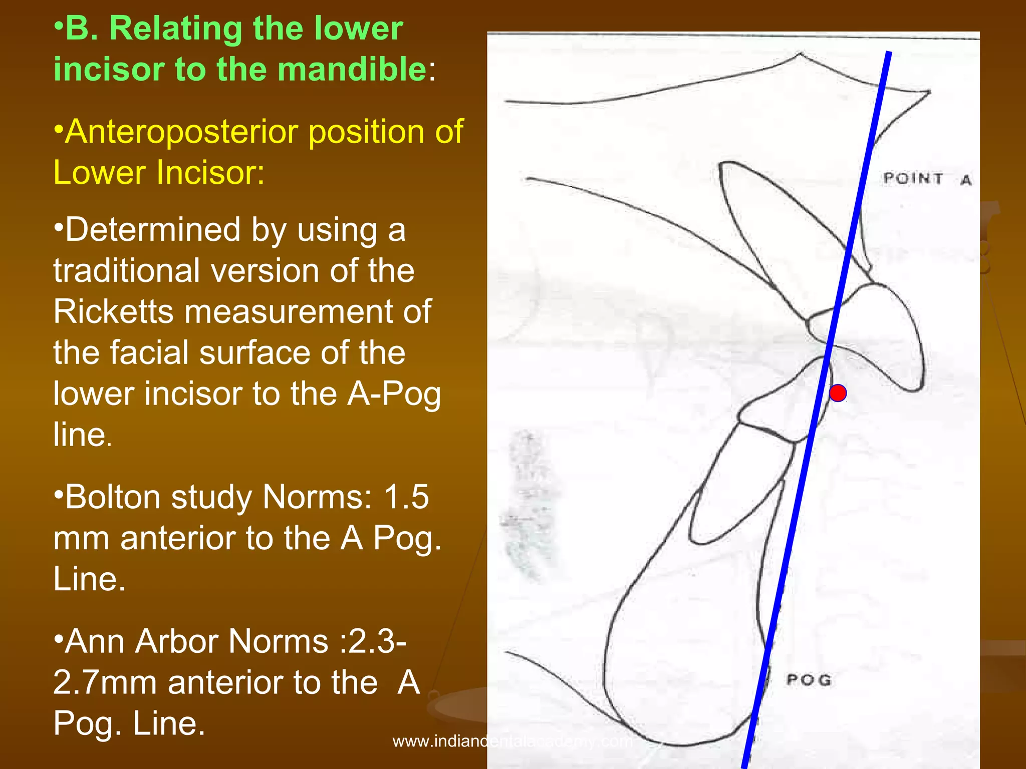 •B. Relating the lower
incisor to the mandible:
•Anteroposterior position of
Lower Incisor:
•Determined by using a
traditional version of the
Ricketts measurement of
the facial surface of the
lower incisor to the A-Pog
line.
•Bolton study Norms: 1.5
mm anterior to the A Pog.
Line.
•Ann Arbor Norms :2.32.7mm anterior to the A
Pog. Line.
www.indiandentalacademy.com

 
