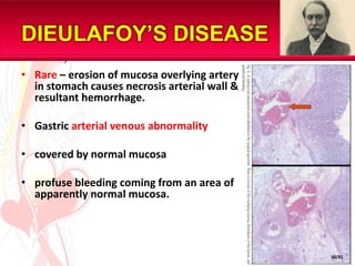 GASTRIC CANCER60-80 years age group.Male:female , 2:1	-	diet	-	H.pylori infection	-	gastric polyps	-	gastroenterostomy	-	chronic gastric ulcer disease	-	chronic atrophic gastritis	-	intestinal metaplasia	-	gastric dysplasia	-	host factorsAETIOLOGICAL FACTOR35/81