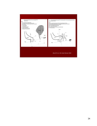 Proctoral Surgeon Performed Ultrasound In Proctological Practice | PDF